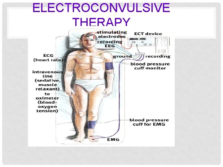 ELECTROCONVULSIVE THERAPY 