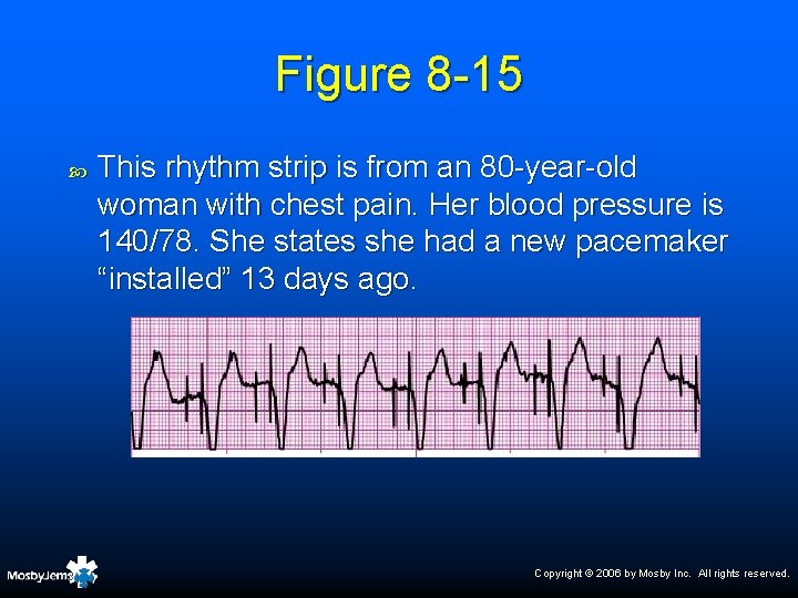 Figure 8 -15 This rhythm strip is from an 80 -year-old woman with chest