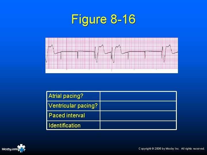Figure 8 -16 Atrial pacing? Ventricular pacing? Paced interval Identification Copyright © 2006 by