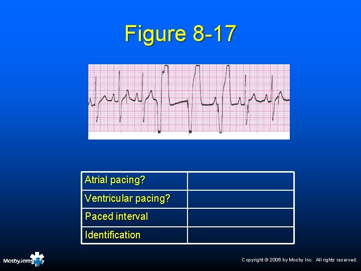 Figure 8 -17 Atrial pacing? Ventricular pacing? Paced interval Identification Copyright © 2006 by