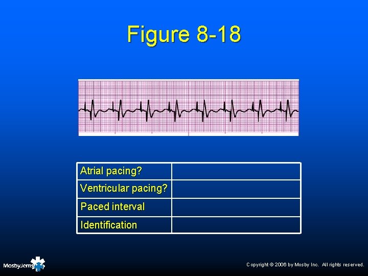 Figure 8 -18 Atrial pacing? Ventricular pacing? Paced interval Identification Copyright © 2006 by