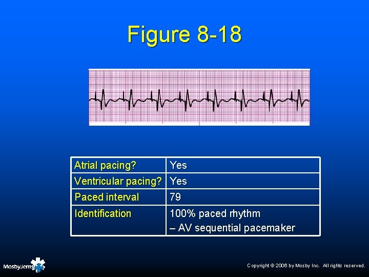 Figure 8 -18 Atrial pacing? Yes Ventricular pacing? Yes Paced interval 79 Identification 100%
