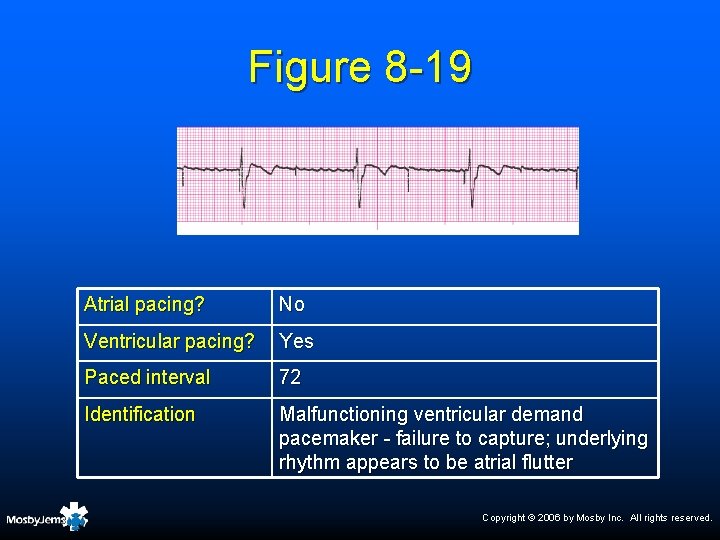 Figure 8 -19 Atrial pacing? No Ventricular pacing? Yes Paced interval 72 Identification Malfunctioning