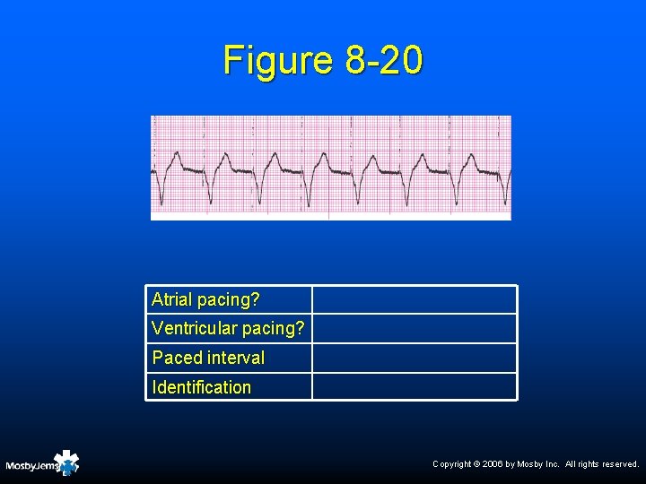 Figure 8 -20 Atrial pacing? Ventricular pacing? Paced interval Identification Copyright © 2006 by