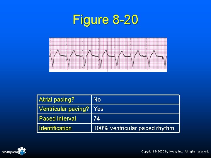 Figure 8 -20 Atrial pacing? No Ventricular pacing? Yes Paced interval 74 Identification 100%