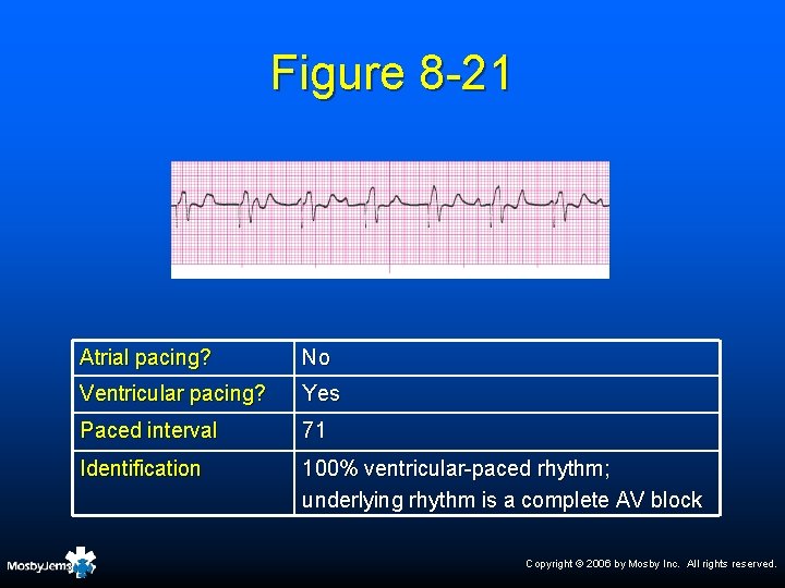 Figure 8 -21 Atrial pacing? No Ventricular pacing? Yes Paced interval 71 Identification 100%