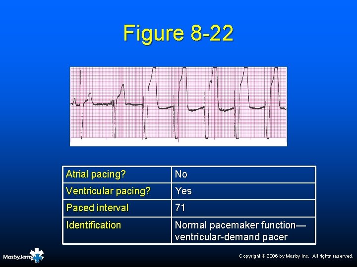 Figure 8 -22 Atrial pacing? No Ventricular pacing? Yes Paced interval 71 Identification Normal