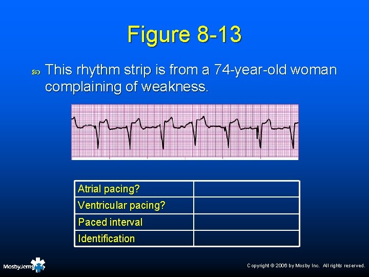 Figure 8 -13 This rhythm strip is from a 74 -year-old woman complaining of