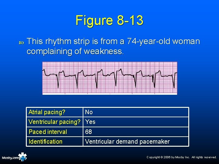 Figure 8 -13 This rhythm strip is from a 74 -year-old woman complaining of