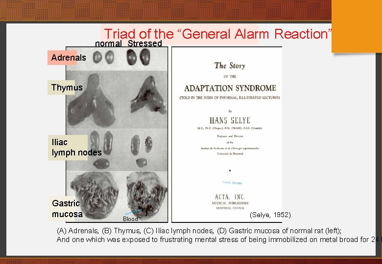 Triad of the “General Alarm Reaction” normal Stressed Adrenals Thymus Iliac lymph nodes Gastric