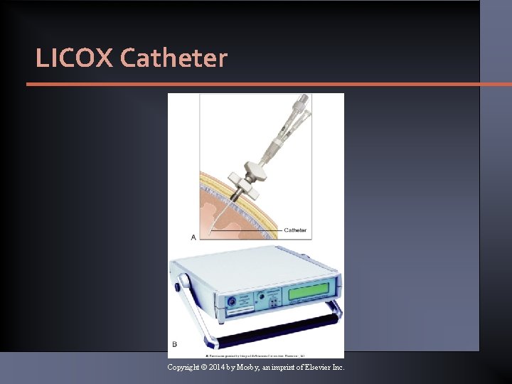 LICOX Catheter Copyright © 2014 by Mosby, an imprint of Elsevier Inc. 