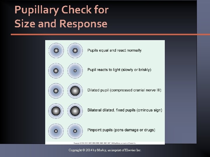 Pupillary Check for Size and Response Copyright © 2014 by Mosby, an imprint of