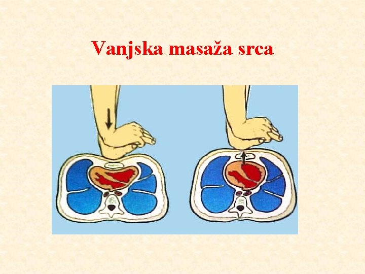 Vanjska masaža srca 