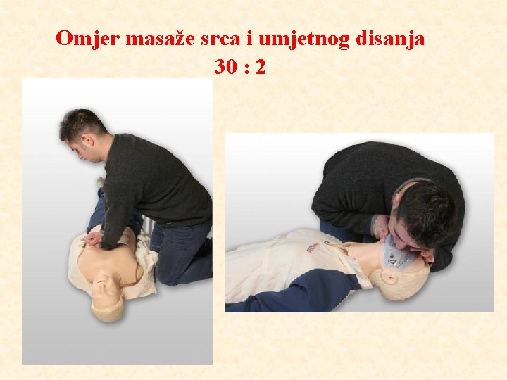 Omjer masaže srca i umjetnog disanja 30 : 2 