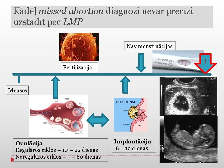 Kādēļ missed abortion diagnozi nevar precīzi uzstādīt pēc LMP Nav menstruācijas ! Fertilizācija Menses