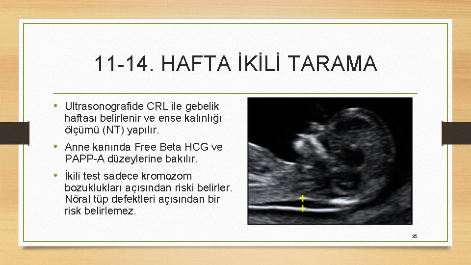 11 -14. HAFTA İKİLİ TARAMA • Ultrasonografide CRL ile gebelik haftası belirlenir ve ense