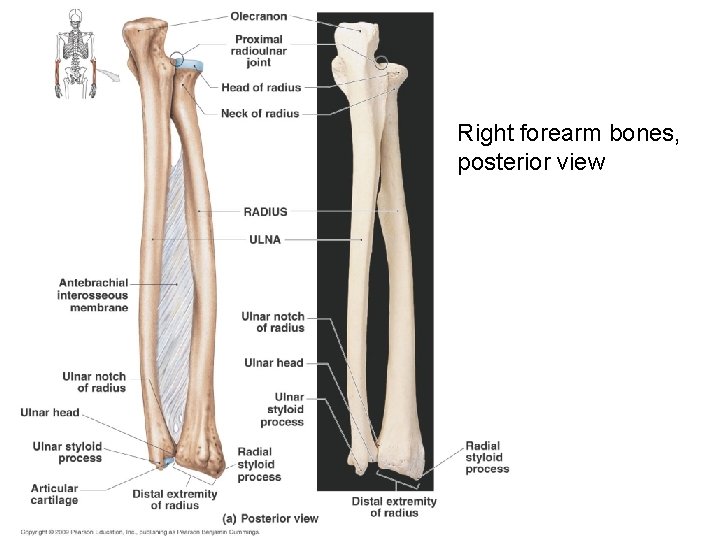 Right forearm bones, posterior view 