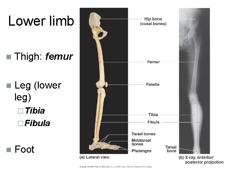 Lower limb n Thigh: femur n Leg (lower leg) ¨ Tibia ¨ Fibula n