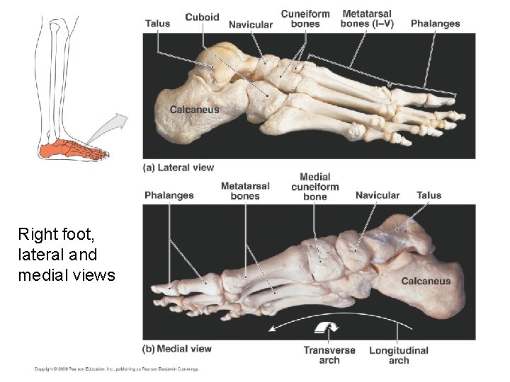 Right foot, lateral and medial views 