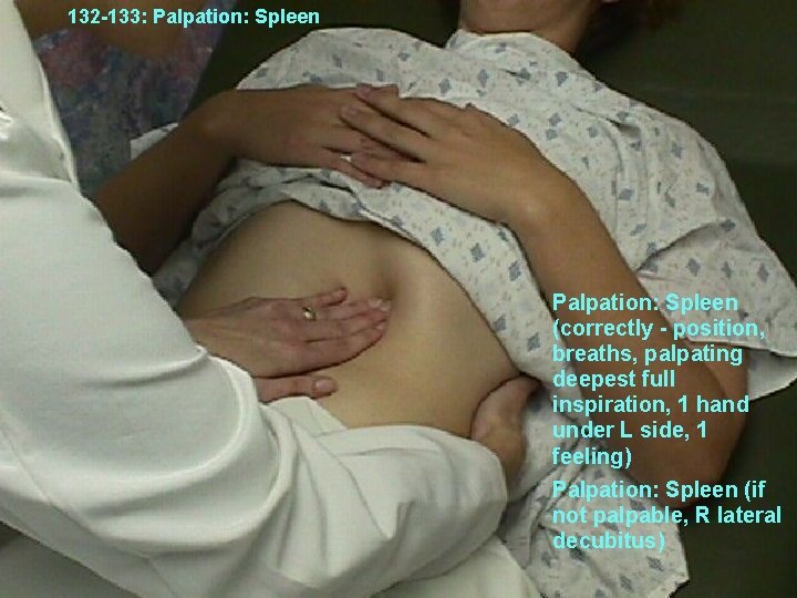 132 -133: Palpation: Spleen (correctly - position, breaths, palpating deepest full inspiration, 1 hand