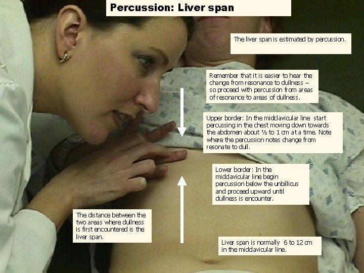Percussion: Liver span The liver span is estimated by percussion. Remember that it is
