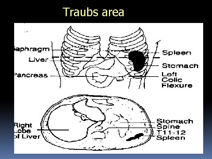 Traubs area 