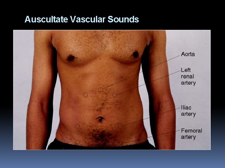 Auscultate Vascular Sounds 