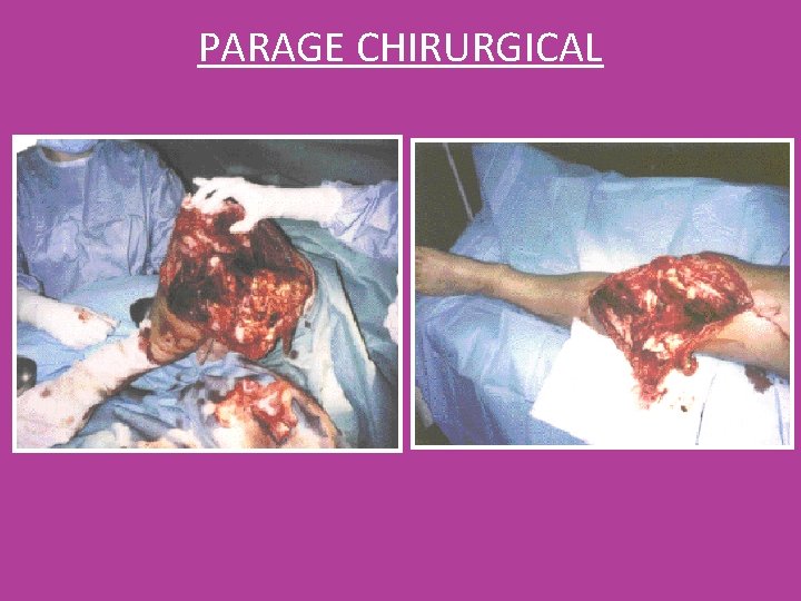 PARAGE CHIRURGICAL PARAGE CHIRURGICAL