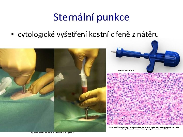 Sternální punkce • cytologické vyšetření kostní dřeně z nátěru http: //www. miltusa. com/ http: