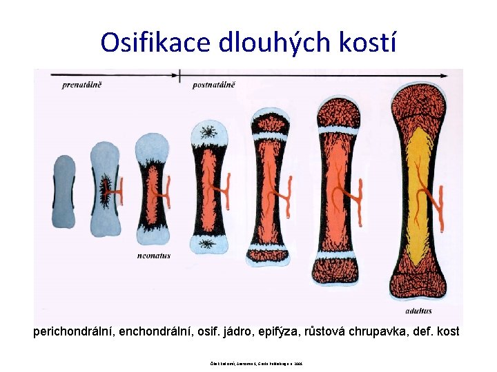 Osifikace dlouhých kostí perichondrální, enchondrální, osif. jádro, epifýza, růstová chrupavka, def. kost Čihák Radomír,