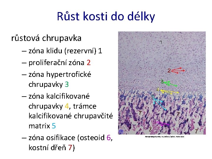 Růst kosti do délky růstová chrupavka – zóna klidu (rezervní) 1 – proliferační zóna