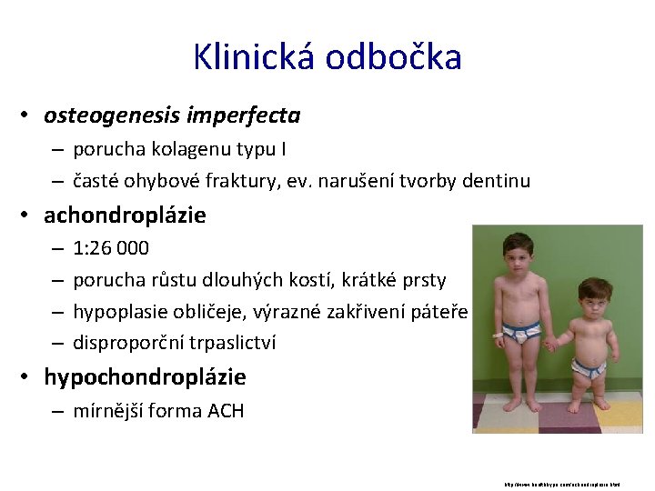 Klinická odbočka • osteogenesis imperfecta – porucha kolagenu typu I – časté ohybové fraktury,