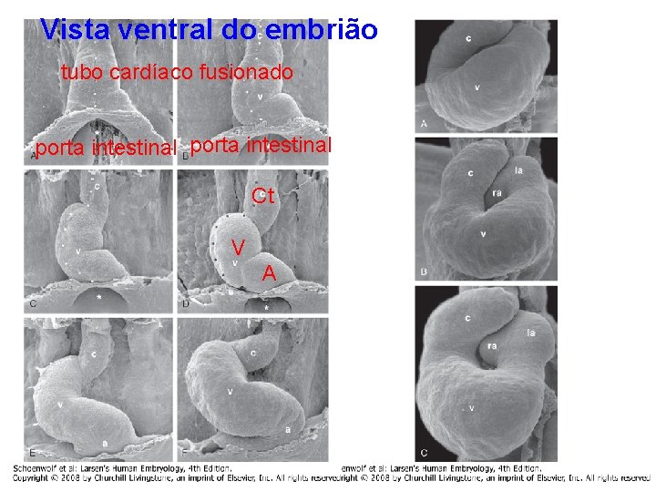Vista ventral do embrião tubo cardíaco fusionado porta intestinal Ct V A 