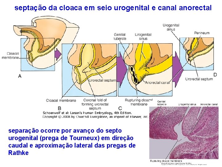 septação da cloaca em seio urogenital e canal anorectal separação ocorre por avanço do