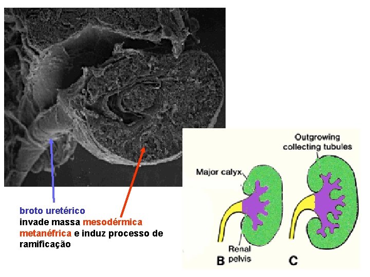 broto uretérico invade massa mesodérmica metanéfrica e induz processo de ramificação 