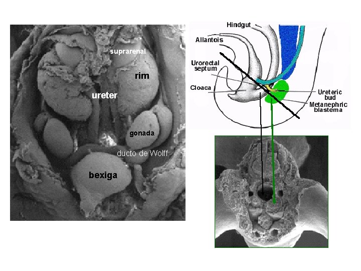suprarenal rim ureter gonada ducto de Wolff bexiga 