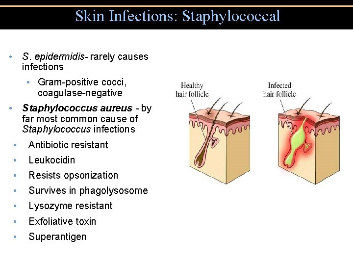 Skin Infections: Staphylococcal • S. epidermidis- rarely causes infections • Gram-positive cocci, coagulase-negative •