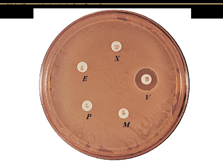 Clinical Focus, Infections in the Gym, Figure C. X E V P M 