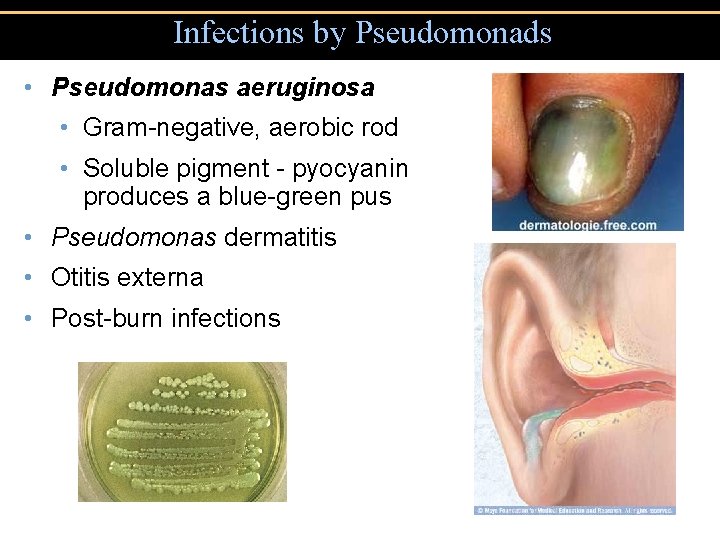 Infections by Pseudomonads • Pseudomonas aeruginosa • Gram-negative, aerobic rod • Soluble pigment -