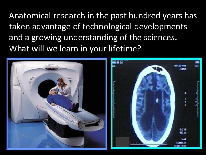 Anatomical research in the past hundred years has taken advantage of technological developments and
