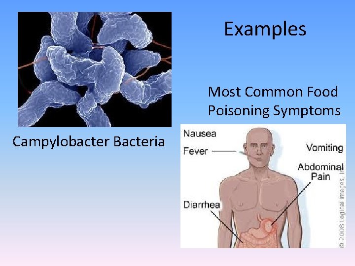 Examples Most Common Food Poisoning Symptoms Campylobacter Bacteria 