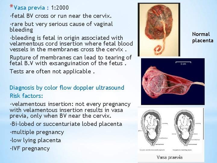 * Vasa previa : 1: 2000 -fetal BV cross or run near the cervix.