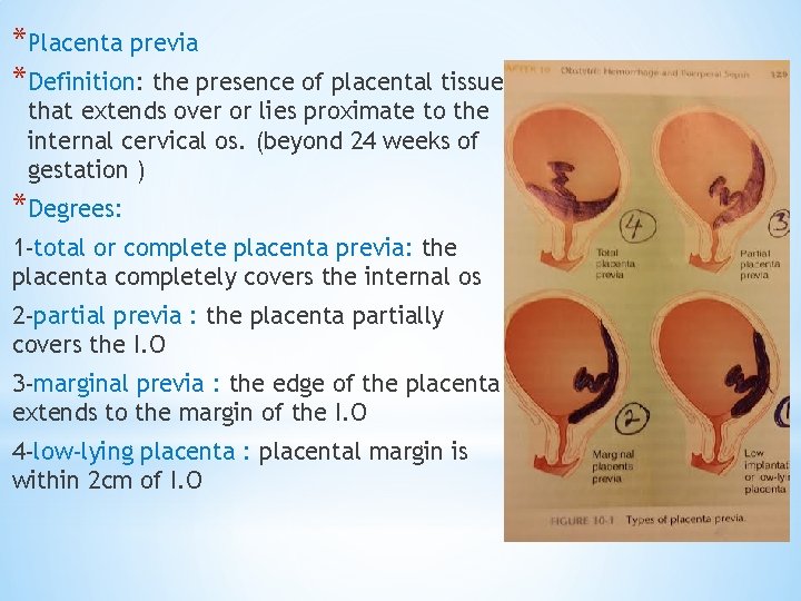*Placenta previa *Definition: the presence of placental tissue that extends over or lies proximate