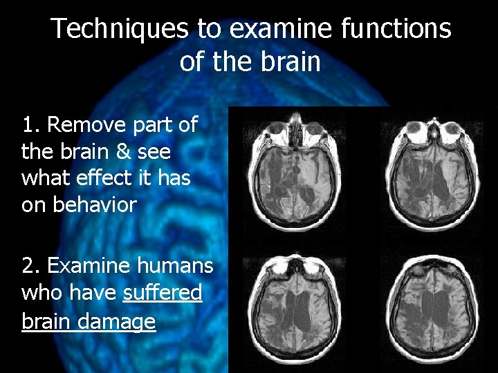 Techniques to examine functions of the brain 1. Remove part of the brain &