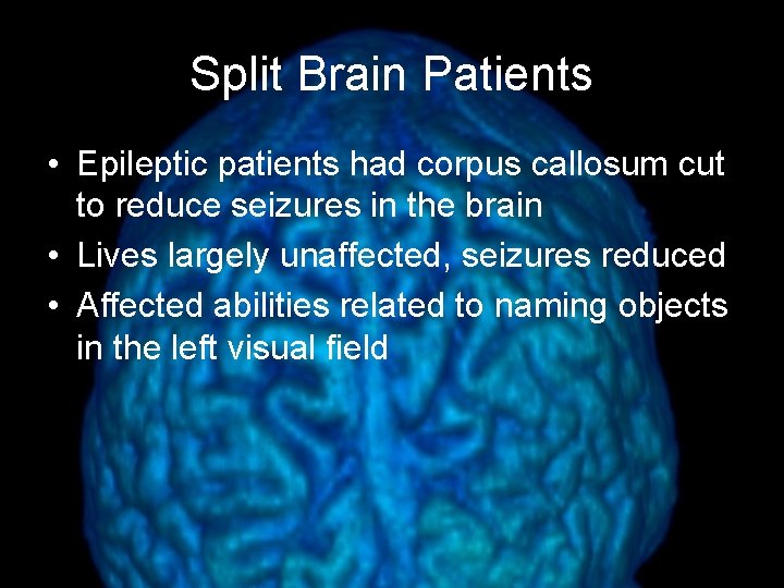 Split Brain Patients • Epileptic patients had corpus callosum cut to reduce seizures in