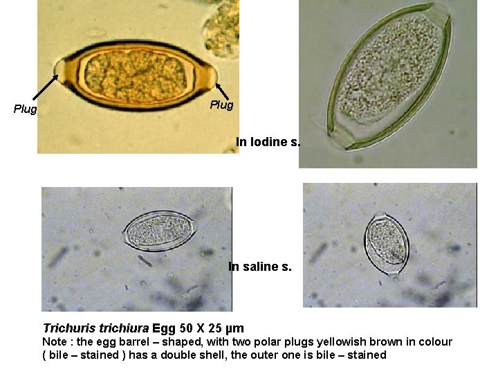 Plug In Iodine s. In saline s. Trichuris trichiura Egg 50 X 25 µm