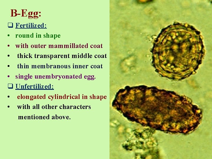 B-Egg: q Fertilized: • round in shape • with outer mammillated coat • thick