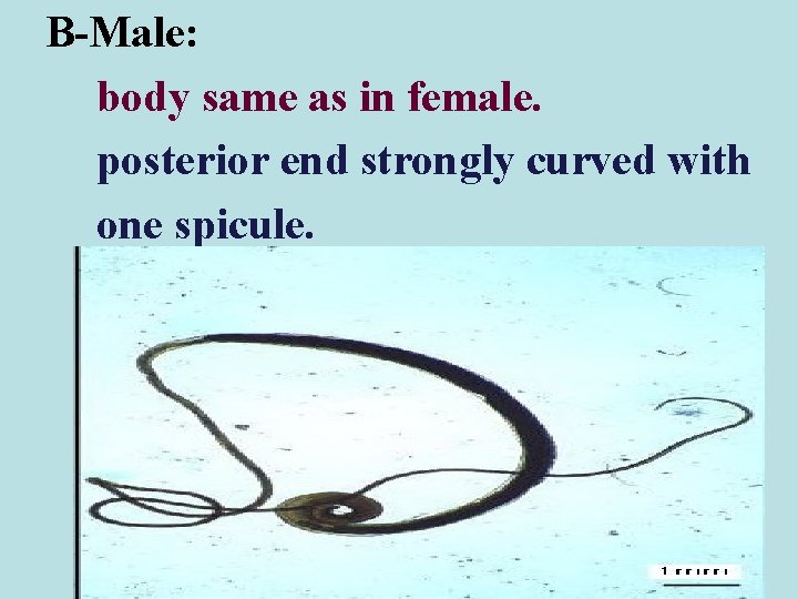 B-Male: body same as in female. posterior end strongly curved with one spicule.