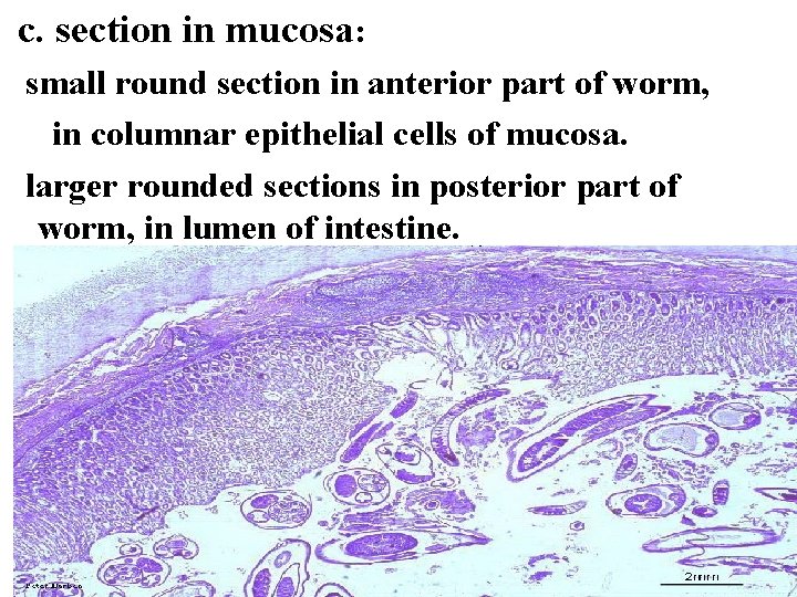  c. section in mucosa: small round section in anterior part of worm, in