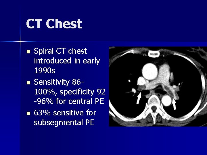 CT Chest n n n Spiral CT chest introduced in early 1990 s Sensitivity